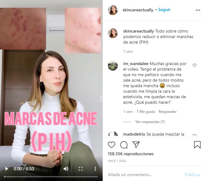 7 cuentas de skincare que debes seguir en Instagram 