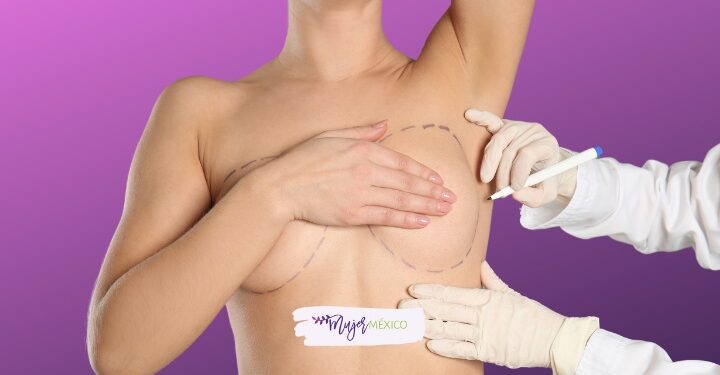 Cosas que debes saber para antes y después de tus implantes de senos