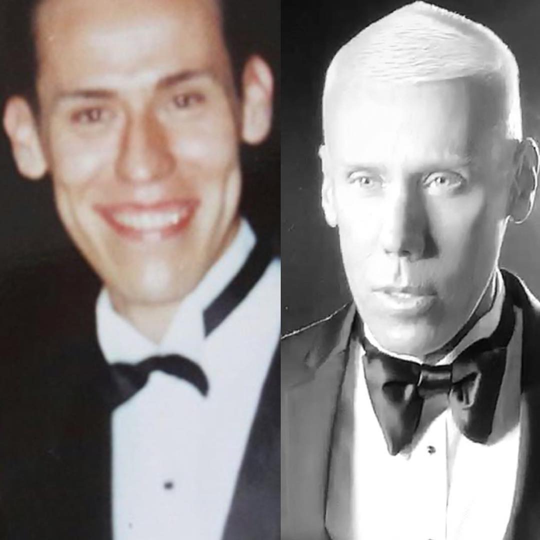 Alfonso Waithsman antes y después de las cirugías