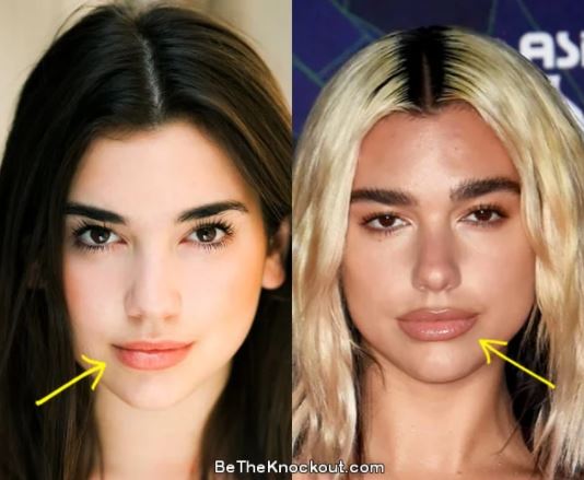 Dua Lipa antes de las cirugías: así fue su transformación