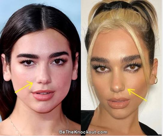 Dua Lipa antes de las cirugías: así fue su transformación