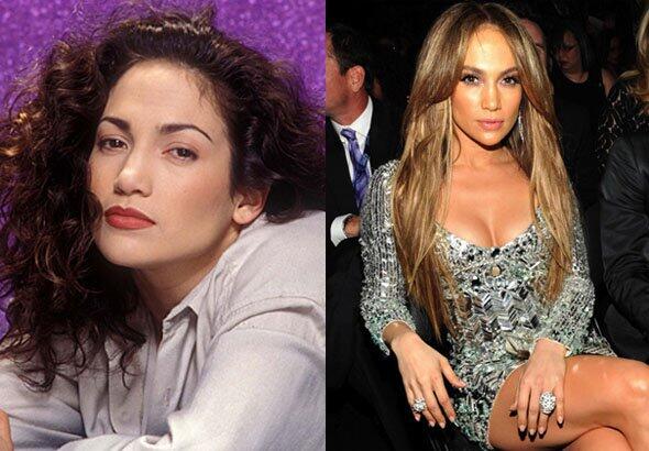 El antes y después de Jennifer Lopez