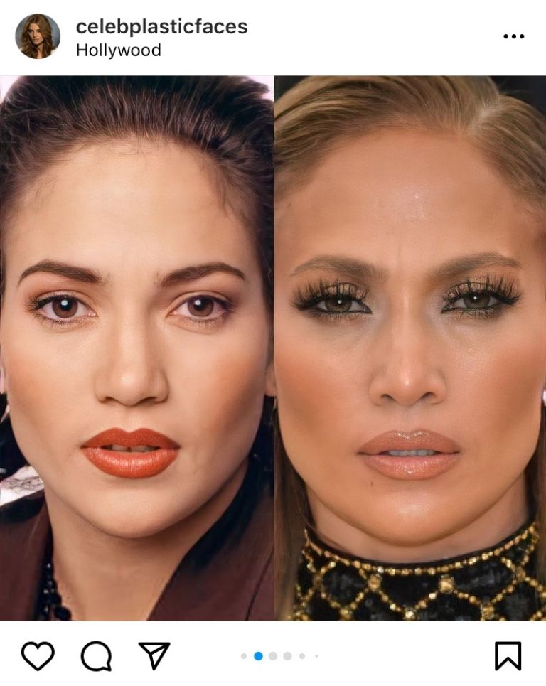 El antes y después de Jennifer Lopez