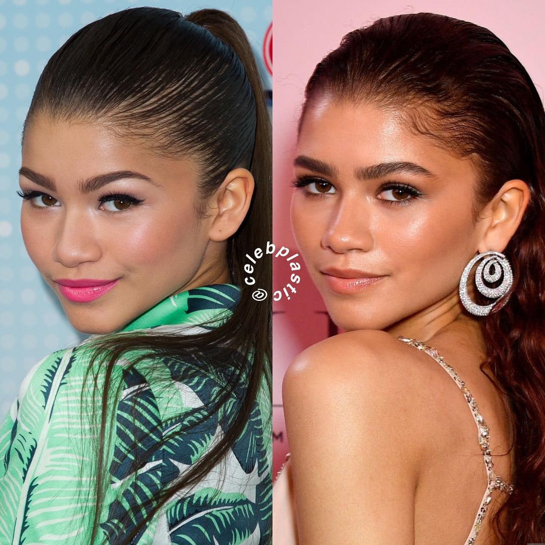 El antes y después de Zendaya