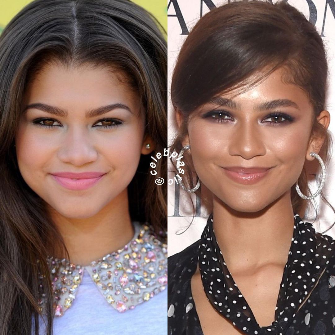 El antes y después de Zendaya