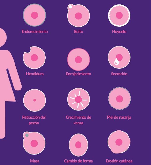 ¿Cuáles son los síntomas del cáncer de mama?
