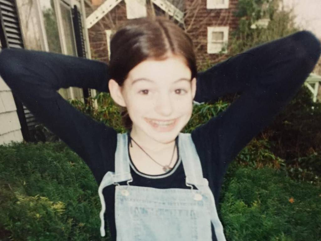 Anne Hathaway antes y después: transformación en fotos 