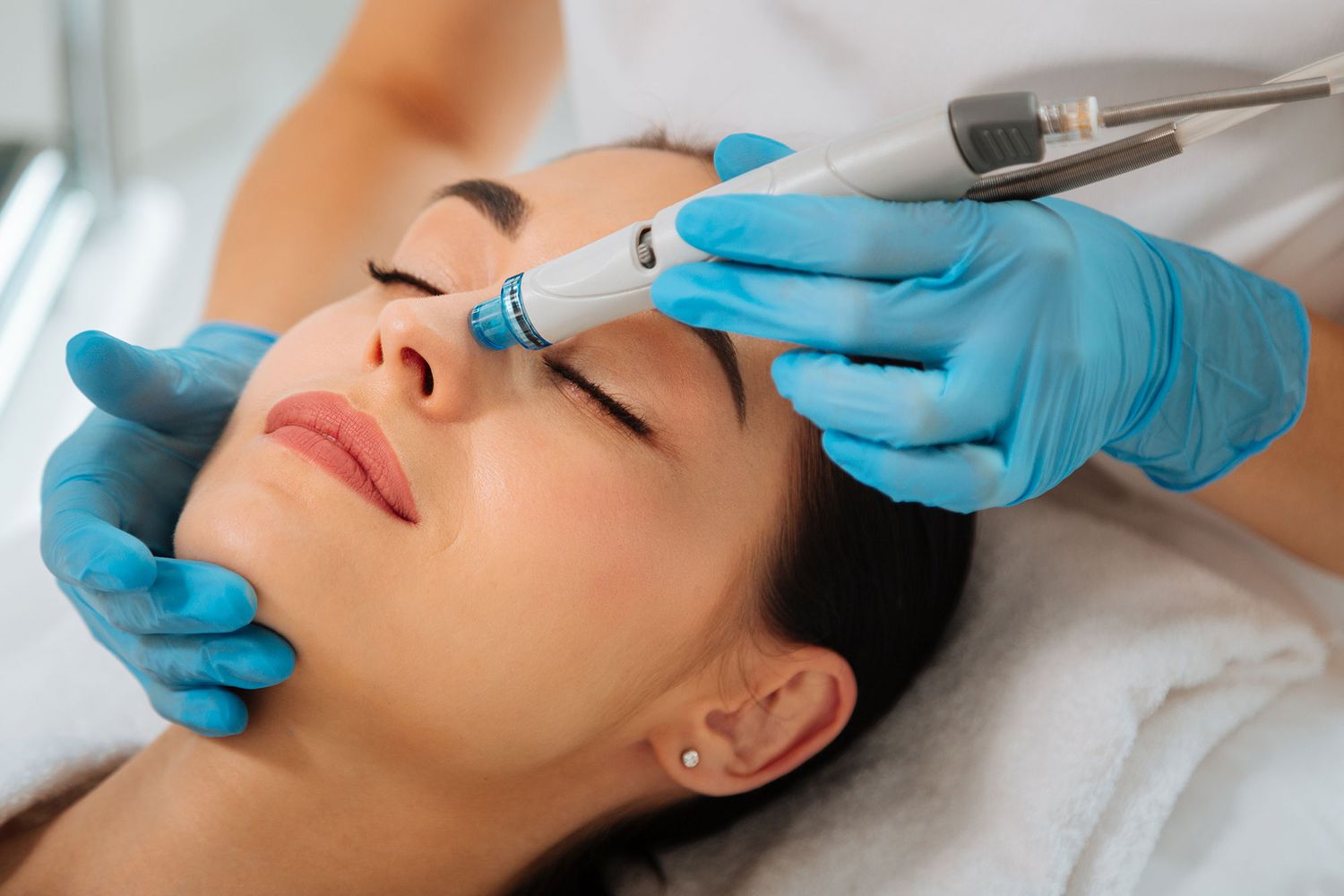 Hydrafacial. ¿Qué es, para qué sirve y cuánto cuesta?