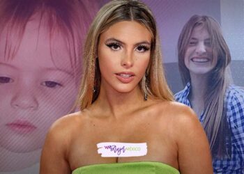 Lele Pons antes de cirugías: así fue transformación