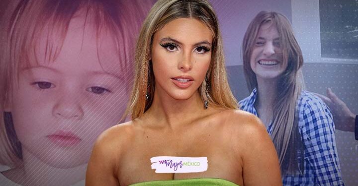 Lele Pons antes de cirugías: así fue transformación