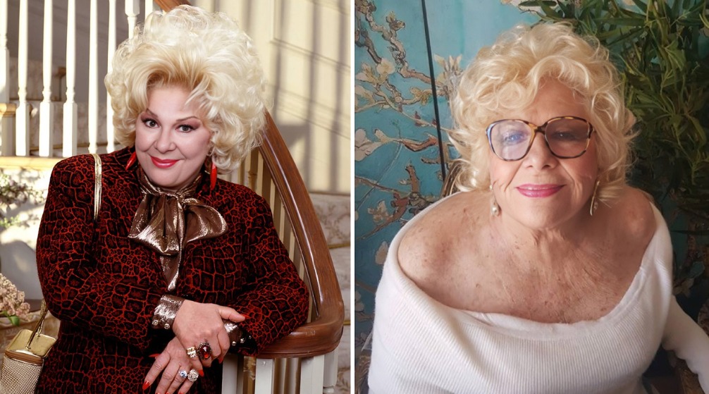 Antes y despúes de Renée Taylor?