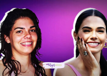 Livia Brito antes y después de las cirugías |FOTOS