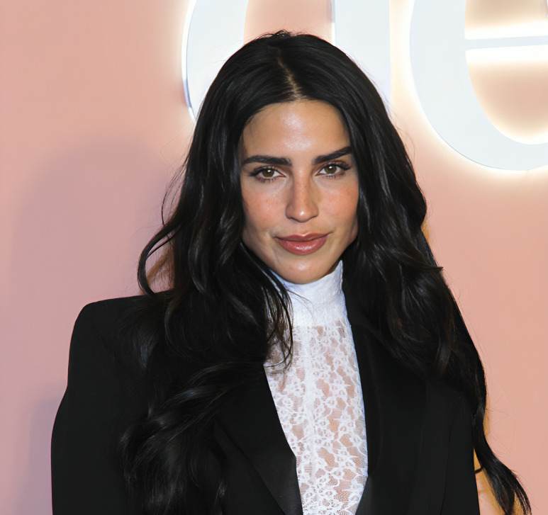 ¿Qué procedimientos estéticos se ha realizado Bárbara de Regil?