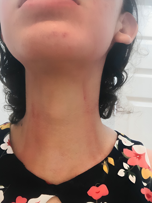 Mujer denuncia agresiones de su exesposo
